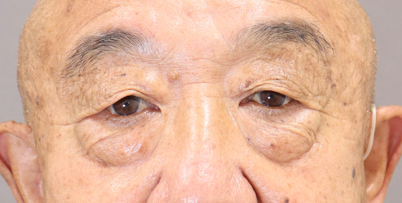 症例写真3-1